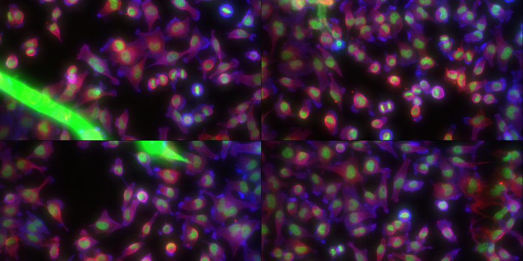 Fluorescence microscopy of HeLa cells