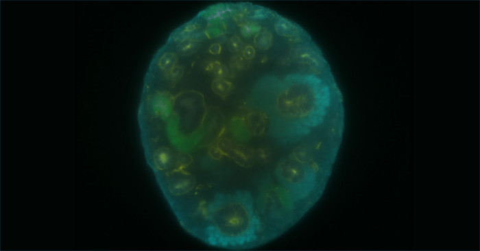 mouse dissociated embryonic kidney cells reforming into a kidney organoid